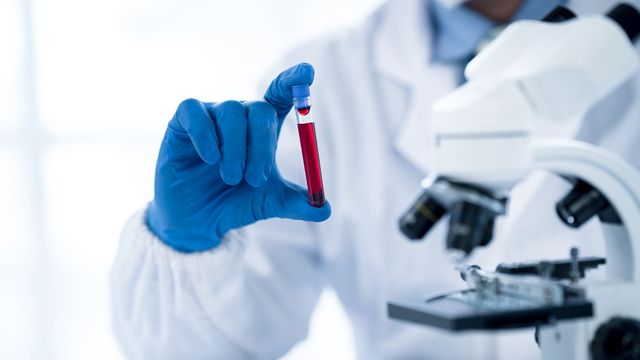 A scientist holds a vial of blood in a gloved hand. 