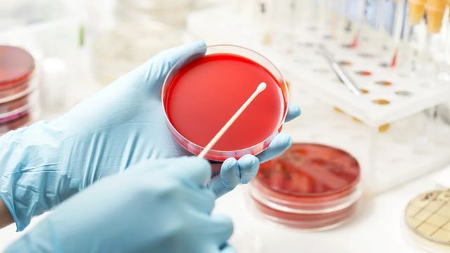 Gloved hands hold an agar dish and a cotton swab. In the background other agar dishes and a test tube rack can be seen.  