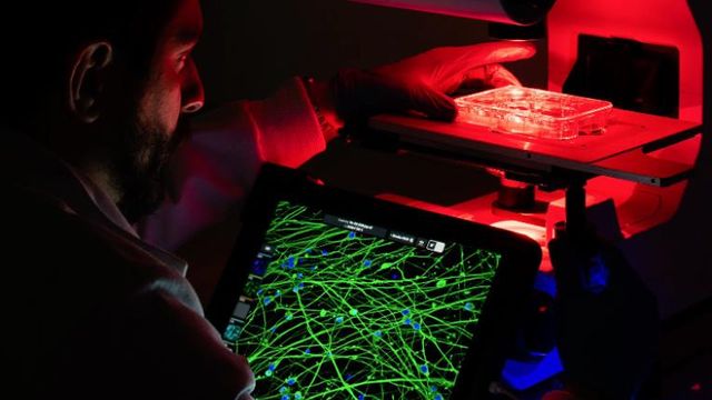 Modeling Neurodegeneration: A Next-Generation Approach To Study Huntington’s Disease content piece image 