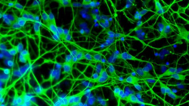 A picture of differentiated SH-SY5Y on Revivocell NANOSTACKS™.  