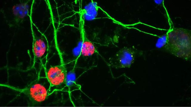 Cortical mouse nerve cells. 