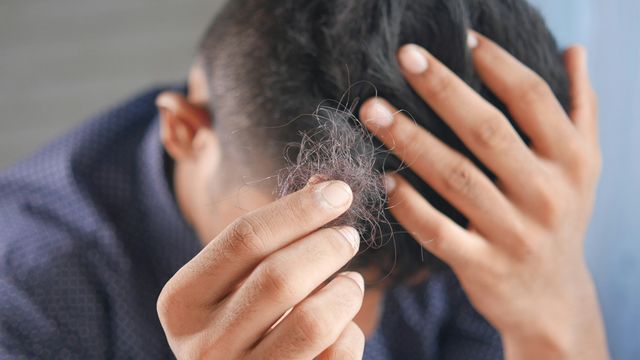 A man holding a clump of his hair and holding his head 