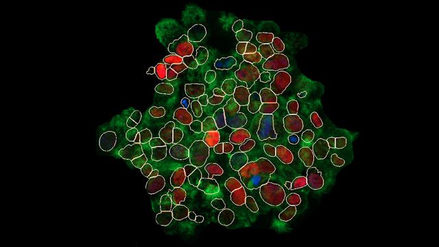 The Latest Advancements in Automated Confocal Imaging 