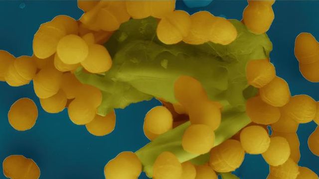 Image from an electron microscope showing how Enterococcus faecalis bacteria clump together to share, among other things, antibiotic resistance with each other. 