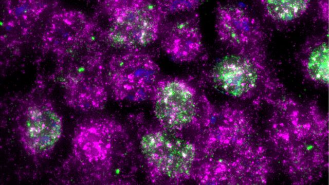 Cells after UV exposure. 